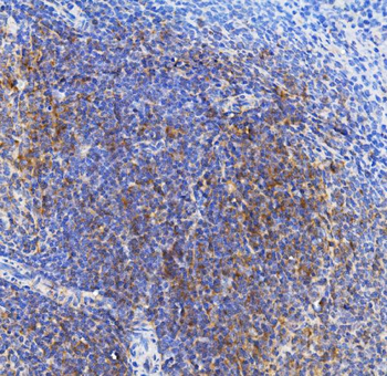 TLR1 TRIM6 Rabbit Polyclonal Antibody
