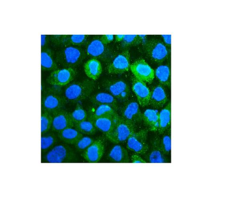 CD59 Antibody (monoclonal, 3C10)