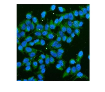 CD59 Antibody (monoclonal, 3C10)