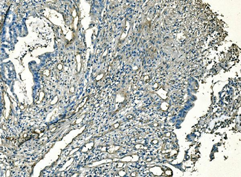 CD59 Antibody (monoclonal, 3C10)