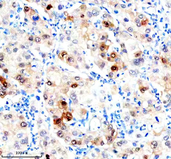 Hsc70 Antibody (monoclonal, 3B6)
