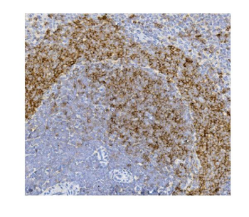 CD79b Mouse Monoclonal Antibody