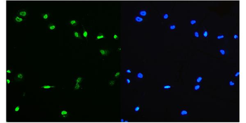 PTBP1 Mouse Monoclonal Antibody