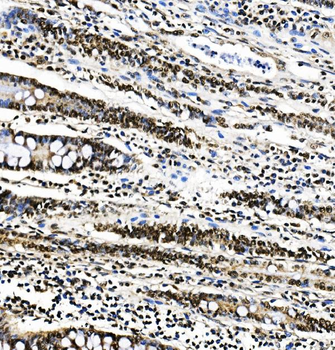 PTBP1 Mouse Monoclonal Antibody