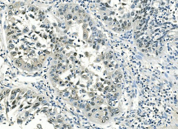 ATF1 Antibody (monoclonal, 7F8)