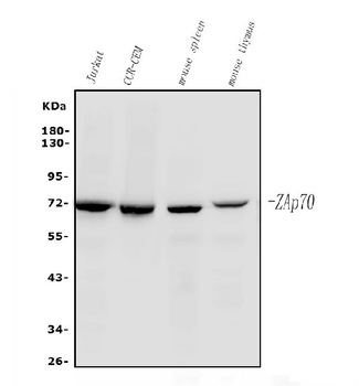 ZAP70 Mouse Monoclonal Antibody