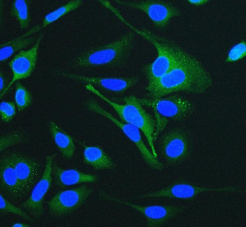 Cytokeratin 18 KRT18 Antibody (monoclonal, 7I6)