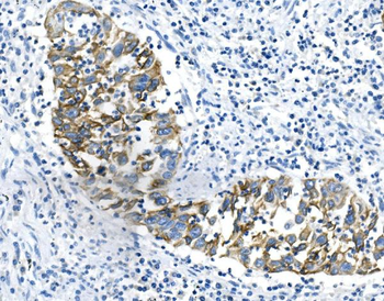 Cytokeratin 18 KRT18 Antibody (monoclonal, 7I6)