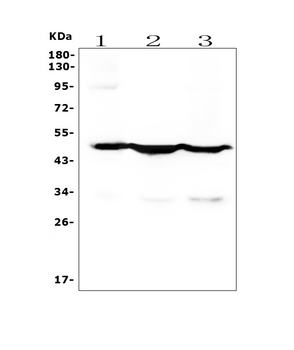 Cytokeratin 18 KRT18 Antibody (monoclonal, 7I6)