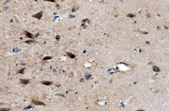 AKR7A2 Picoband® Rabbit Polyclonal Antibody