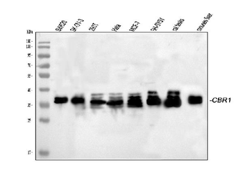 CBR1 Antibody