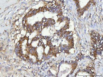 CBR1 Antibody
