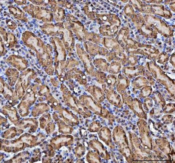 CBR1 Antibody