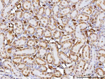CBR1 Antibody
