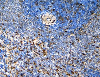 CCR6 Antibody