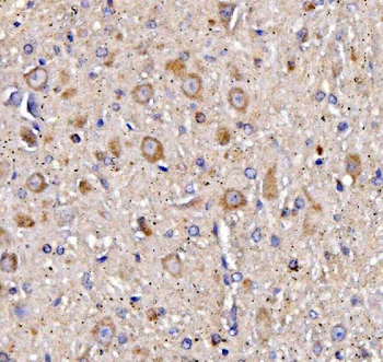 Muscarinic Acetylcholine Receptor 1/CHRM1 Rabbit Polyclonal Antibody
