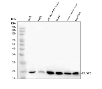DUSP3 Rabbit Polyclonal Antibody