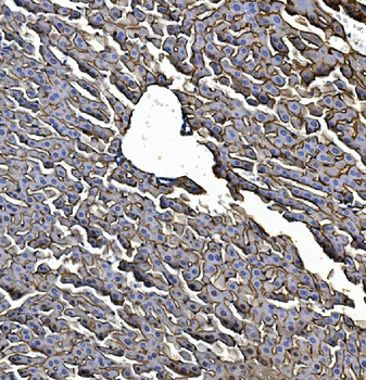 EGFR Rabbit Polyclonal Antibody