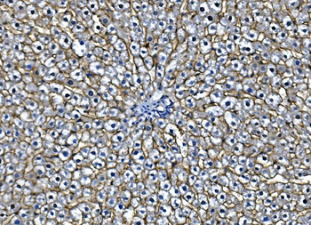 EGFR Rabbit Polyclonal Antibody