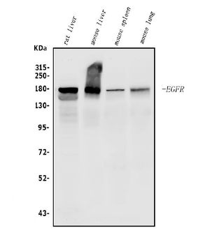 EGFR Rabbit Polyclonal Antibody