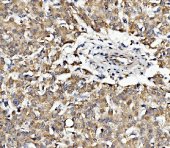 Band 4.1-like protein 5 EPB41L5 Rabbit Polyclonal Antibody