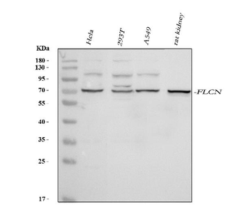 FLCN Rabbit Polyclonal Antibody