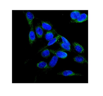 FLCN Rabbit Polyclonal Antibody