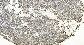 FLCN Rabbit Polyclonal Antibody