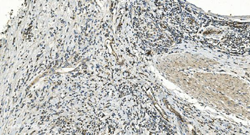 FLCN Rabbit Polyclonal Antibody