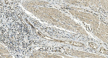 FLCN Rabbit Polyclonal Antibody