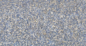 FLCN Rabbit Polyclonal Antibody