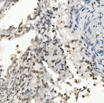 FOXF1 Rabbit Polyclonal Antibody