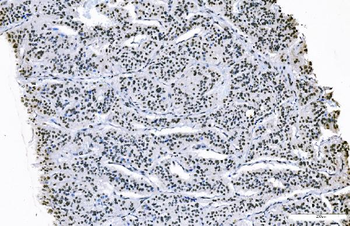 FOXK1/MNF Picoband® Rabbit Polyclonal Antibody