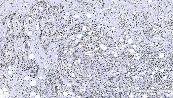 FOXK1/MNF Picoband® Rabbit Polyclonal Antibody