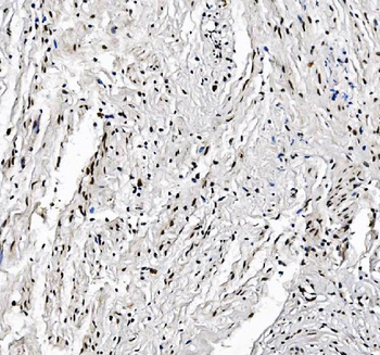 FOXK1/MNF Picoband® Rabbit Polyclonal Antibody