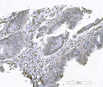 FOXK1/MNF Picoband® Rabbit Polyclonal Antibody