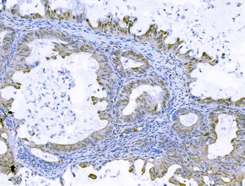 FOXK1/MNF Picoband® Rabbit Polyclonal Antibody