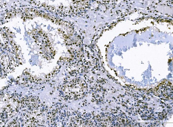 FOXK1/MNF Picoband® Rabbit Polyclonal Antibody