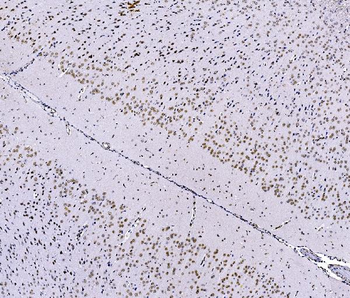 FOXK1/MNF Picoband® Rabbit Polyclonal Antibody