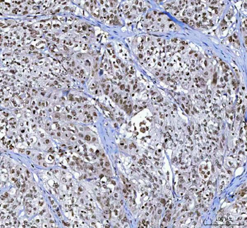 Menin/MEN1 Rabbit Polyclonal Antibody