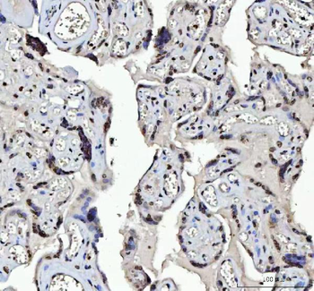 Menin/MEN1 Rabbit Polyclonal Antibody
