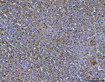 Mannose Receptor/MRC1 Antibody