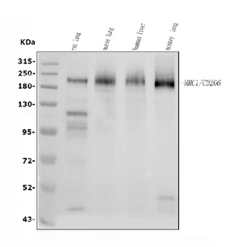 Mannose Receptor/MRC1 Antibody