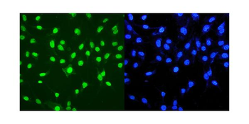 MTA2/PID Rabbit Polyclonal Antibody