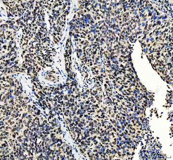 MTA2/PID Rabbit Polyclonal Antibody