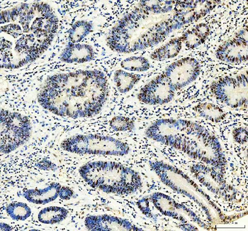 MTA2/PID Rabbit Polyclonal Antibody