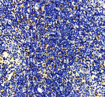 MTA2/PID Rabbit Polyclonal Antibody