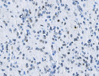 MTA2/PID Rabbit Polyclonal Antibody