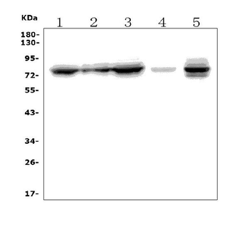 MTA2/PID Rabbit Polyclonal Antibody