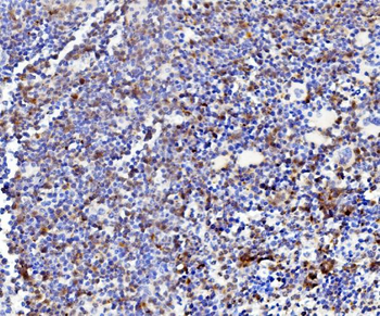 Niemann Pick C2/NPC2 Antibody